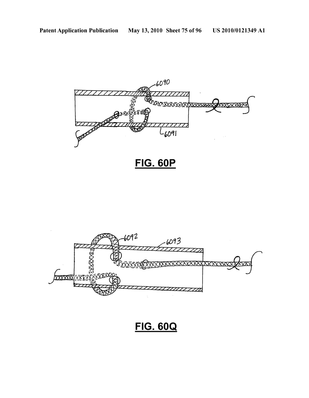 TERMINATION DEVICES AND RELATED METHODS - diagram, schematic, and image 76