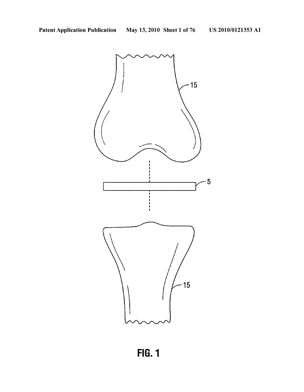 METHOD AND APPARATUS FOR MENISCAL REPAIR - diagram, schematic, and image 02