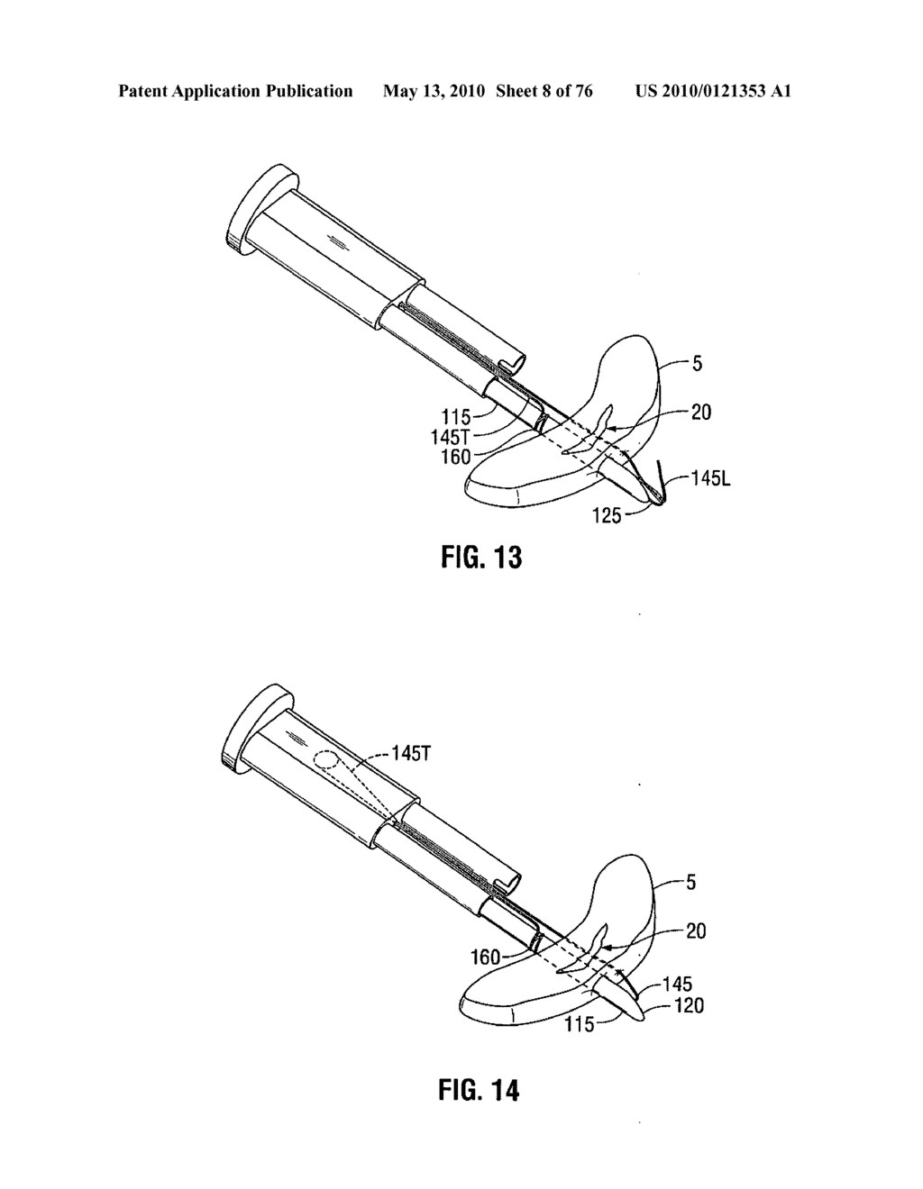 METHOD AND APPARATUS FOR MENISCAL REPAIR - diagram, schematic, and image 09