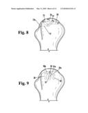 DEVICE FOR THE INTRAOSTEAL SEIZING OF SUTURES diagram and image