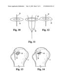 DEVICE FOR THE INTRAOSTEAL SEIZING OF SUTURES diagram and image