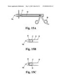 DEVICE FOR THE INTRAOSTEAL SEIZING OF SUTURES diagram and image