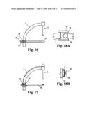 DEVICE FOR THE INTRAOSTEAL SEIZING OF SUTURES diagram and image