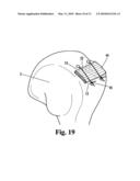 DEVICE FOR THE INTRAOSTEAL SEIZING OF SUTURES diagram and image