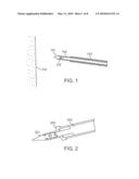 METHODS AND DEVICES FOR SUTURE ANCHOR DELIVERY diagram and image