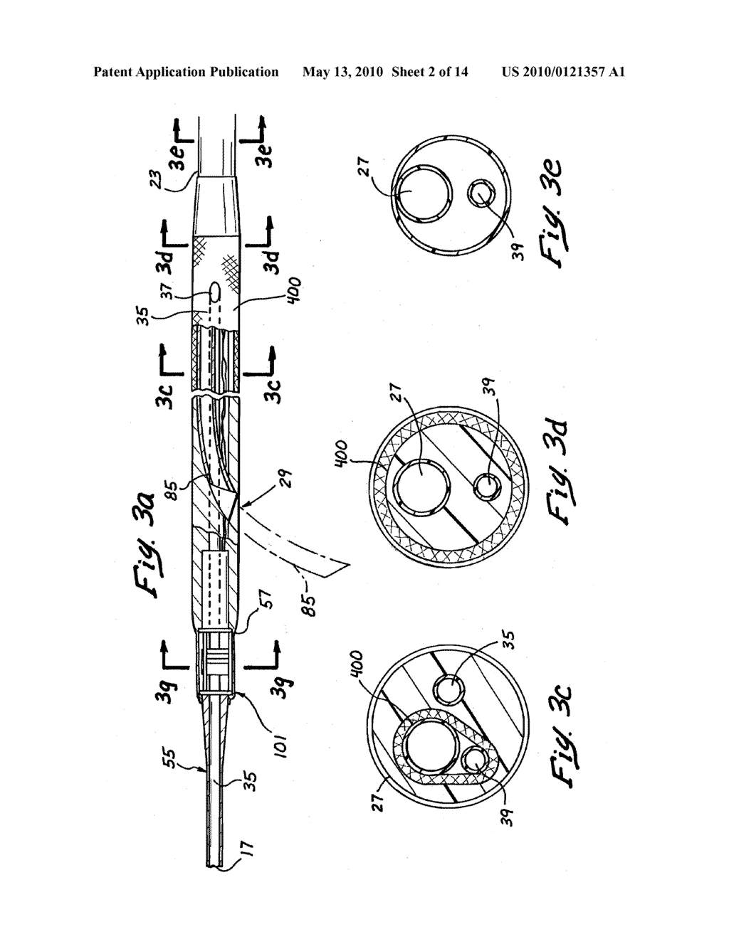 Tissue Penetrating Catheters having Integral Imaging Transducers and Their Methods of Use - diagram, schematic, and image 03