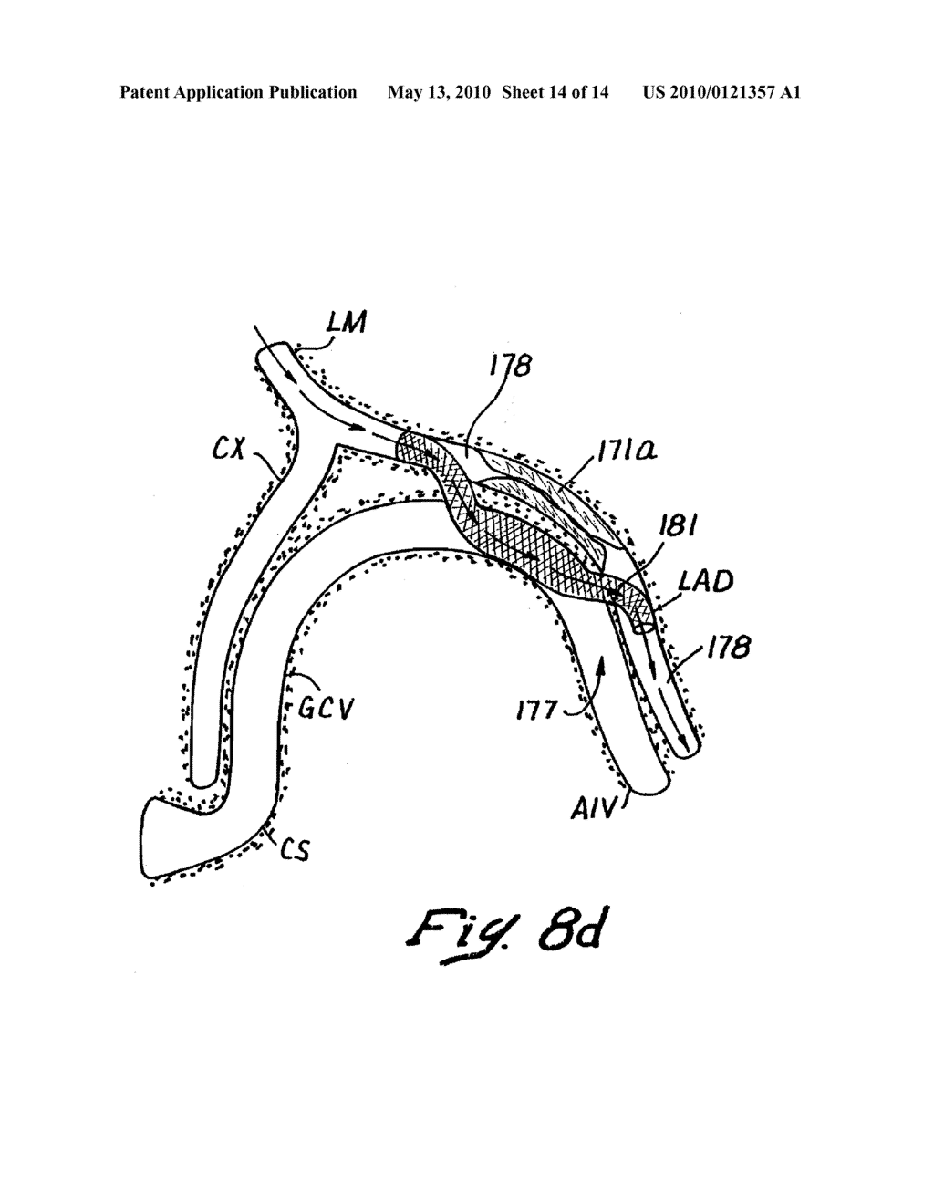 Tissue Penetrating Catheters having Integral Imaging Transducers and Their Methods of Use - diagram, schematic, and image 15