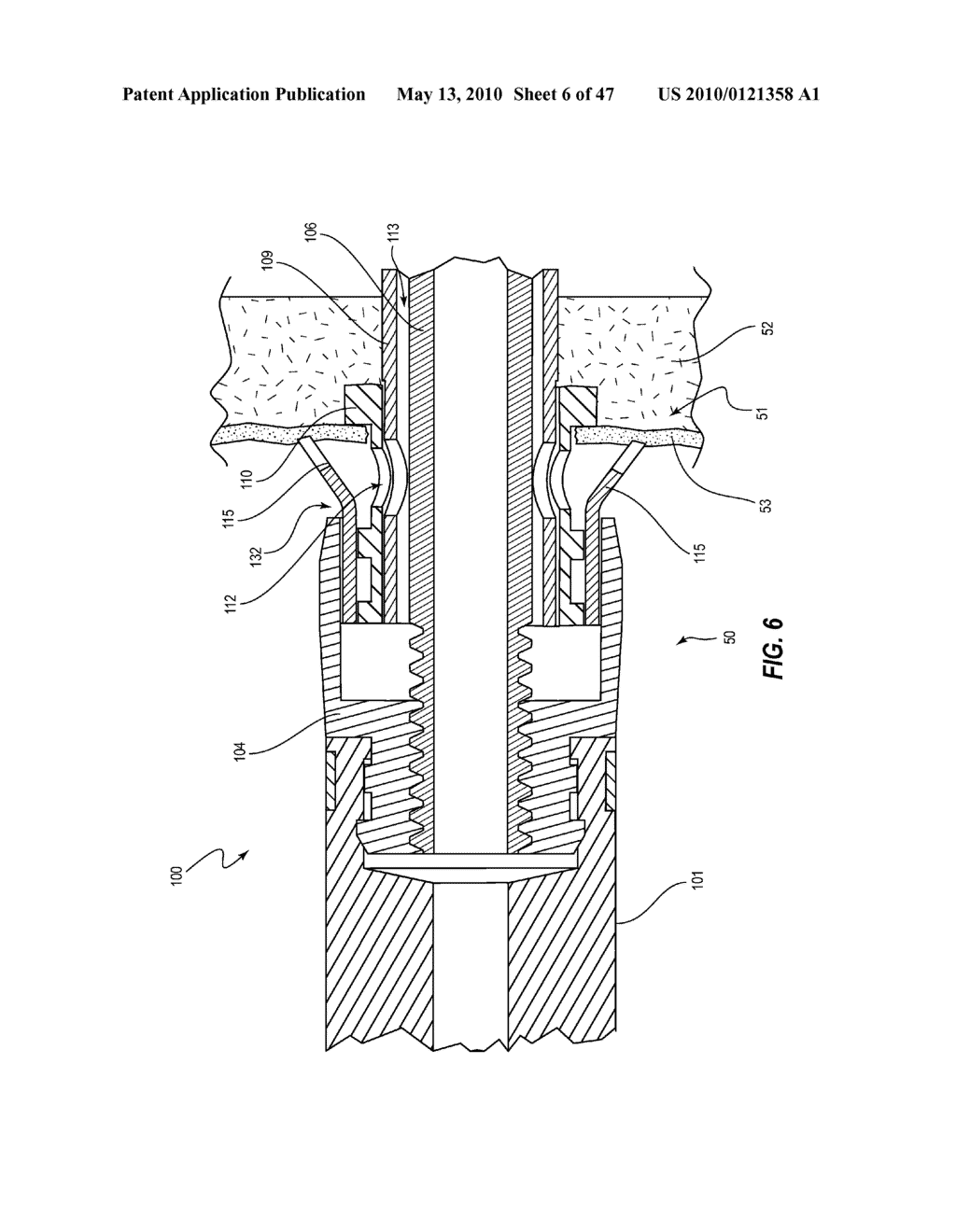 TISSUE MANAGEMENT METHODS, APPARATUS, AND SYSTEMS - diagram, schematic, and image 07