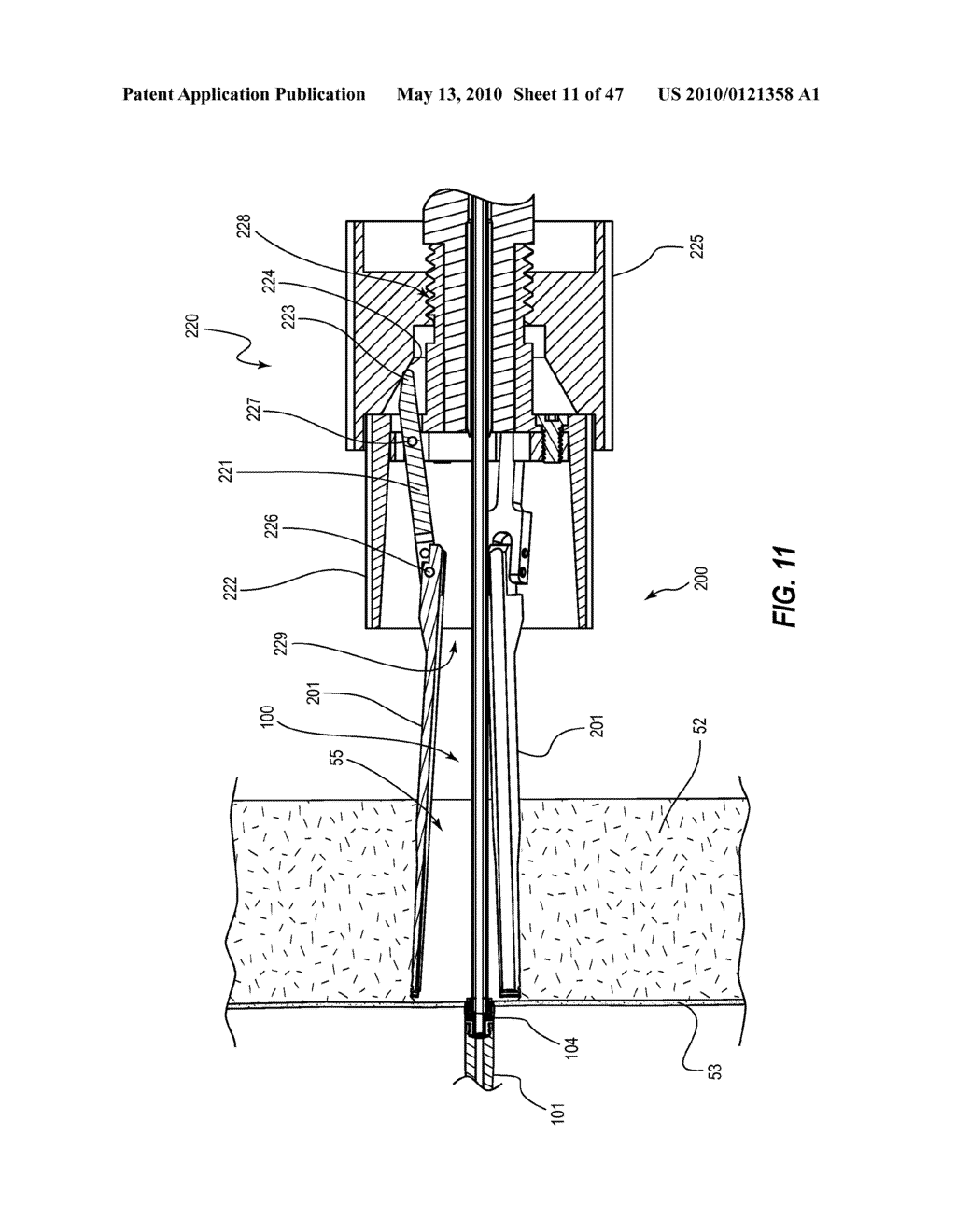 TISSUE MANAGEMENT METHODS, APPARATUS, AND SYSTEMS - diagram, schematic, and image 12