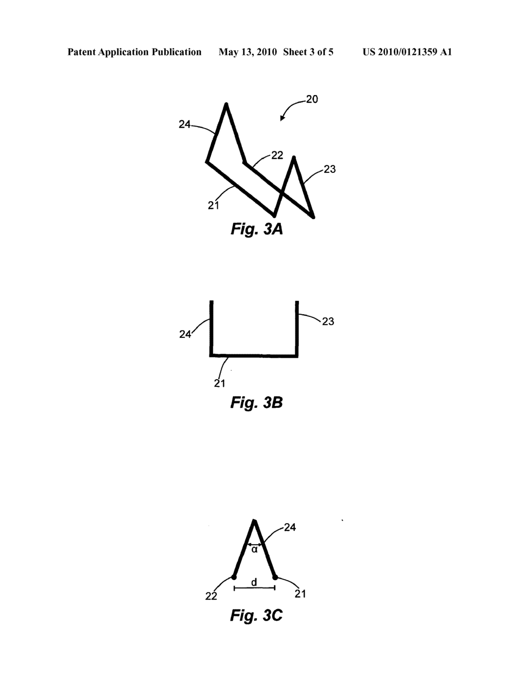 HAEMOSTATIC CLIP, DEVICE TO APPLY A HAEMOSTATIC CLIP AND ITS USE - diagram, schematic, and image 04
