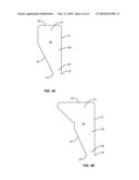 Progressive Reduction Instrument for Reduction of a Vertebral Rod and Method of Use diagram and image