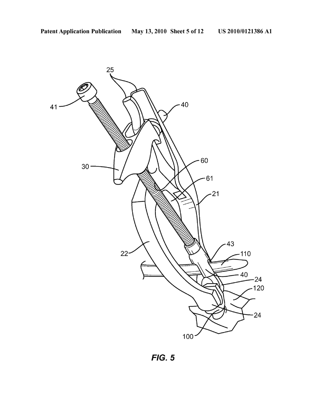 Progressive Reduction Instrument for Reduction of a Vertebral Rod and Method of Use - diagram, schematic, and image 06