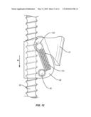 Progressive Reduction Instrument for Reduction of a Vertebral Rod and Method of Use diagram and image