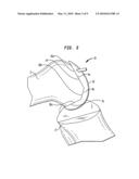 Method of preparing a femur for implantation of a femoral implant diagram and image