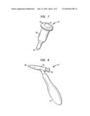Method of preparing a femur for implantation of a femoral implant diagram and image