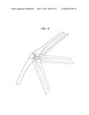 Method of preparing a femur for implantation of a femoral implant diagram and image