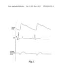 PULSE DETECTION METHOD AND APPARATUS USING PATIENT IMPEDANCE diagram and image