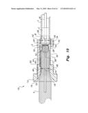 Stent compression tool diagram and image