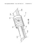 ENDOPROSTHESIS DELIVERY SYSTEM diagram and image