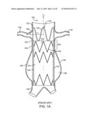 Stent Graft Having a Flexible, Articulable, and Axially Compressible Branch Graft diagram and image