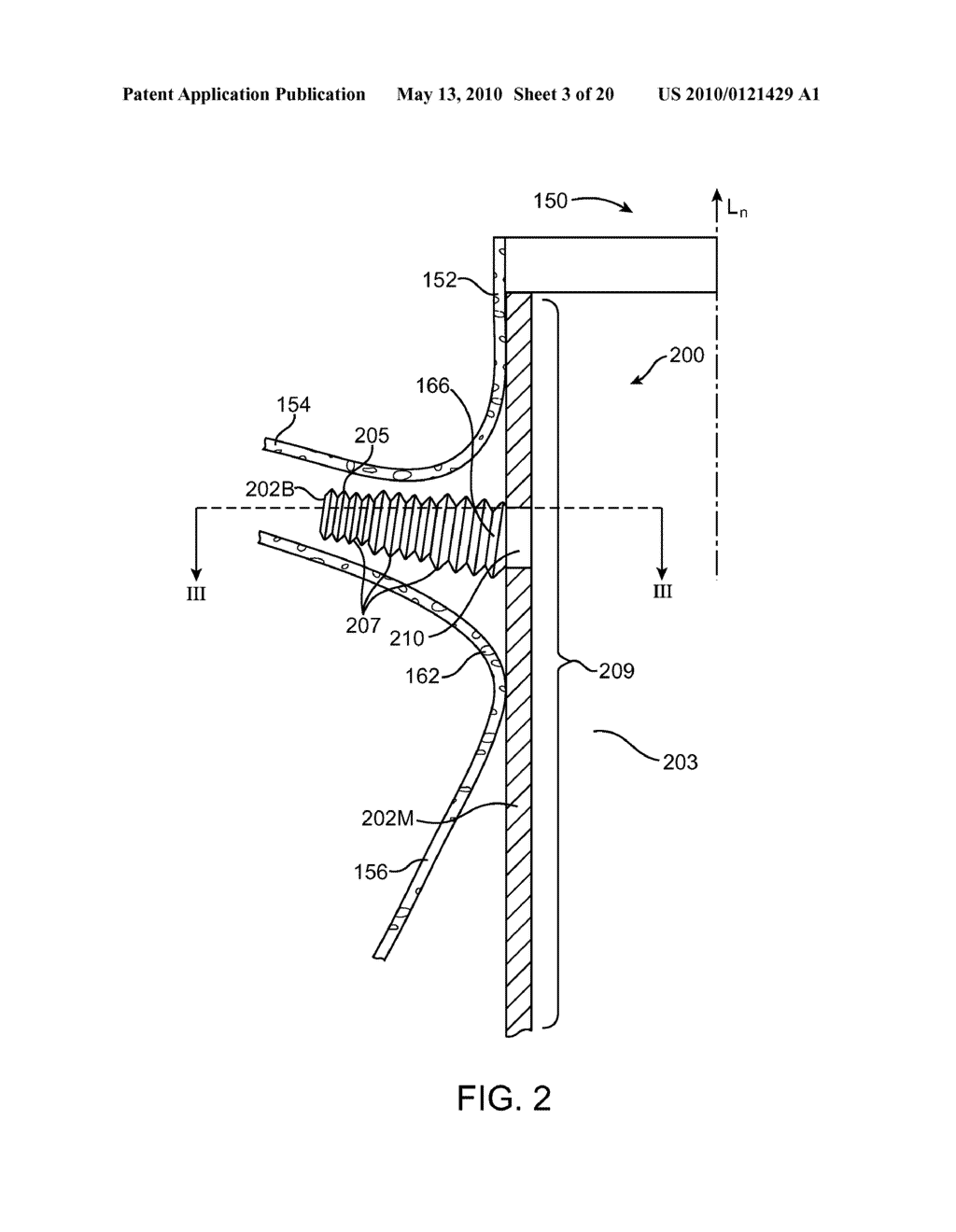 Stent Graft Having a Flexible, Articulable, and Axially Compressible Branch Graft - diagram, schematic, and image 04