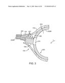 Stent Graft Having a Flexible, Articulable, and Axially Compressible Branch Graft diagram and image