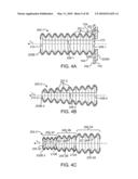 Stent Graft Having a Flexible, Articulable, and Axially Compressible Branch Graft diagram and image