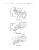 Stent Graft Having a Flexible, Articulable, and Axially Compressible Branch Graft diagram and image