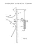 Stent Graft Having a Flexible, Articulable, and Axially Compressible Branch Graft diagram and image