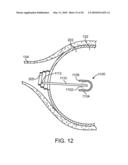 Stent Graft Having a Flexible, Articulable, and Axially Compressible Branch Graft diagram and image