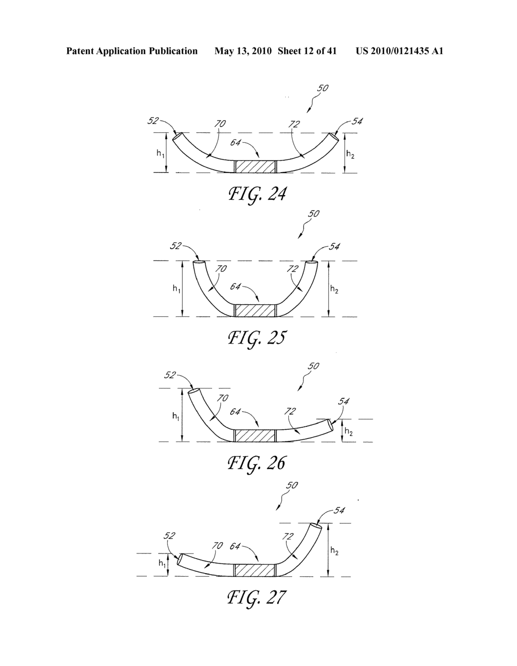 PERCUTANEOUS TRANSVALVULAR INTRANNULAR BAND FOR MITRAL VALVE REPAIR - diagram, schematic, and image 13