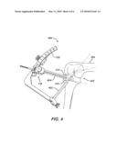 METHOD FOR REPLACING A LIGAMENT IN A KNEE diagram and image