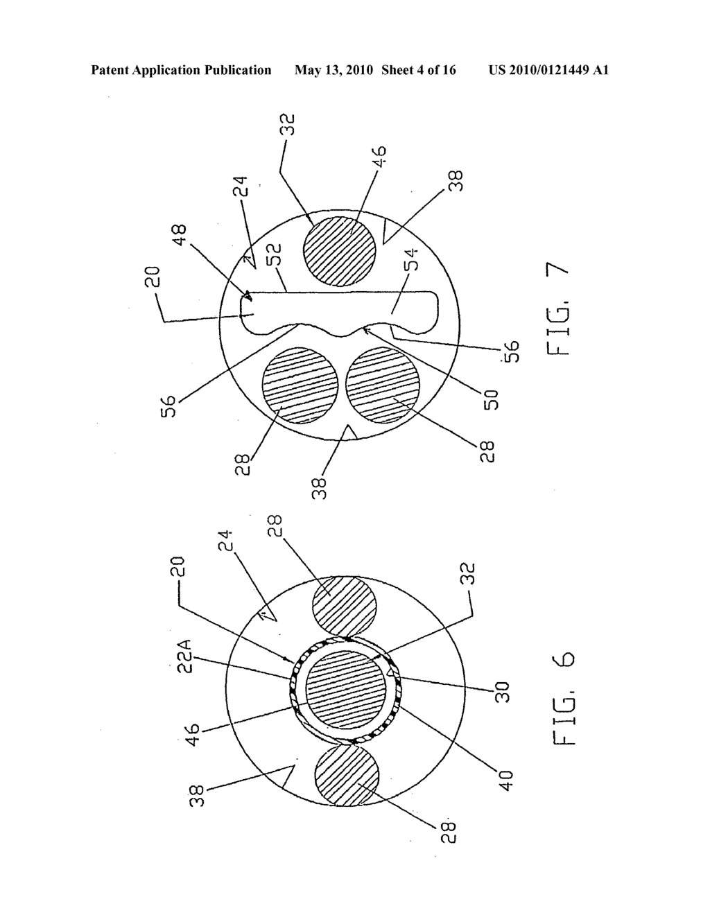 Graft ligament anchor and method for attaching a graft ligament to a bone - diagram, schematic, and image 05