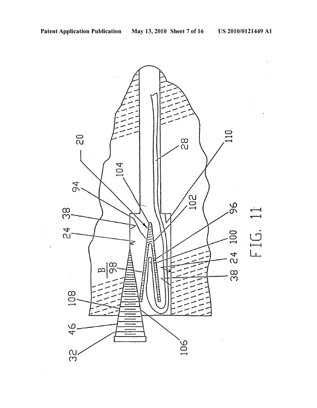 Graft ligament anchor and method for attaching a graft ligament to a bone - diagram, schematic, and image 08