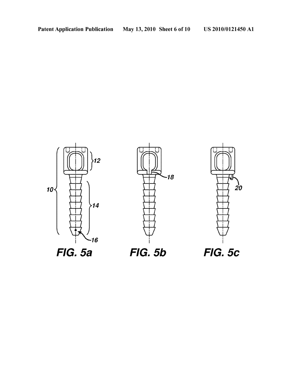 METHOD FOR ANCHORING AUTOLOGOUS OR ARTIFICIAL TENDON GRAFTS IN BONE - diagram, schematic, and image 07