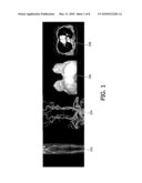 AUTOMATIC DISPLAY OF SYMMETRIC ANATOMICAL STRUCTURE diagram and image