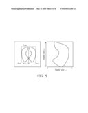 AUTOMATIC DISPLAY OF SYMMETRIC ANATOMICAL STRUCTURE diagram and image