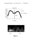 AUTOMATIC DISPLAY OF SYMMETRIC ANATOMICAL STRUCTURE diagram and image