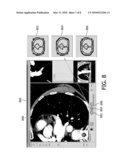 AUTOMATIC DISPLAY OF SYMMETRIC ANATOMICAL STRUCTURE diagram and image