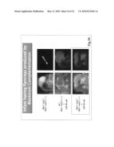 Organ regeneration method utilizing blastocyst complementation diagram and image