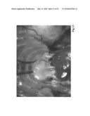 Organ regeneration method utilizing blastocyst complementation diagram and image