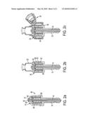 Modular outward opening solenoid direct fuel injector diagram and image