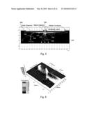 A SINGLE-PHOTON DETECTOR WITH A QUANTUM DOT AND A NANO-INJECTOR diagram and image