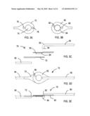 HID LAMP WITH A CANTED ARC TUBE diagram and image