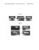 HIGHLY RESILIENT COPOLYMER WITH SHAPE RECOVERY FORCE AND FLEXIBILITY AND THE USE THEREOF FOR THE REPAIR OF ARTICULAR CARTILAGE DEFECTS diagram and image