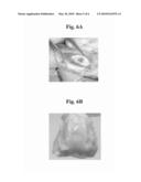 HIGHLY RESILIENT COPOLYMER WITH SHAPE RECOVERY FORCE AND FLEXIBILITY AND THE USE THEREOF FOR THE REPAIR OF ARTICULAR CARTILAGE DEFECTS diagram and image