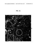 EXTRACELLULAR MATRIX COMPOSITIONS FOR THE TREATMENT OF CANCER diagram and image