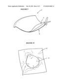 BRASSIERES diagram and image