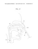 ENDOSCOPE SYSTEM AND ASSIST DEVICE diagram and image