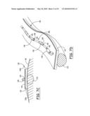 SUBCUTANEOUS LEAD GUIDANCE diagram and image